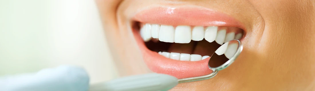 A person with nice teeth, smiling.