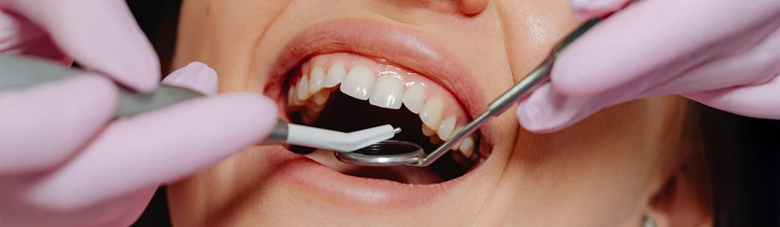 A person getting their teeth cleaned.